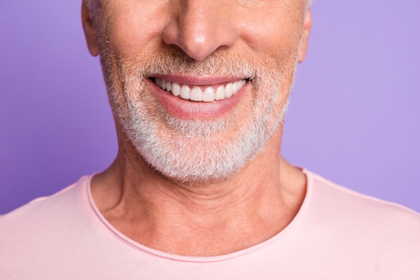 How To Care For Your Dental Veneers